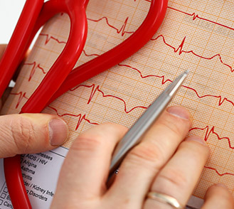 Résultats d'un électrocardiogramme - MACSF