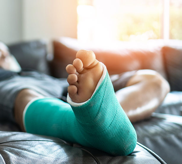 Un homme avec un plâtre à la jambe installé sur son canapé - MACSF