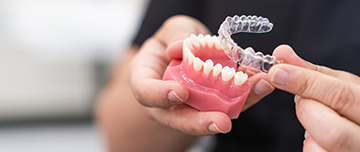 Un orthodontiste présente un moulage de mâchoire et une gouttière dentaire - MACSF