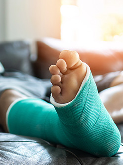 Un homme avec un plâtre à la jambe installé sur son canapé - MACSF